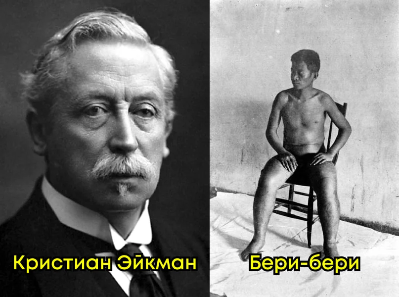 Кристиан Эйкман и историческая фотография больного бери-бери