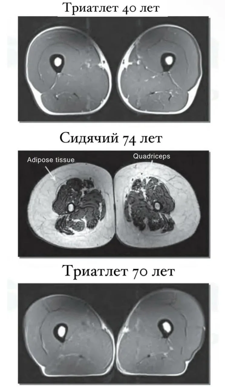 Сравнение мышечной ткани тренирующихся и нетренирующихся людей